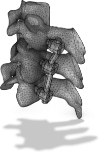 STL Import Tutorial Series